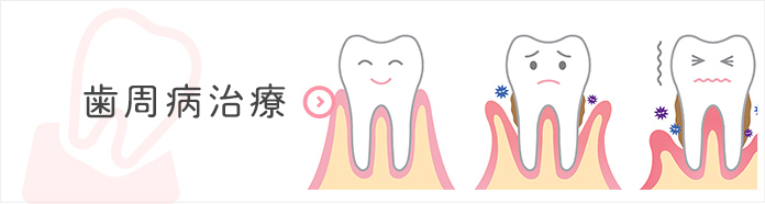 歯周病治療