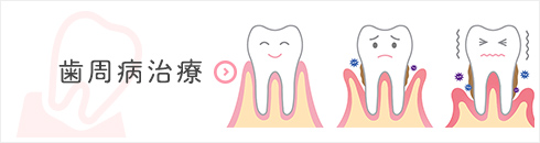 歯周病治療